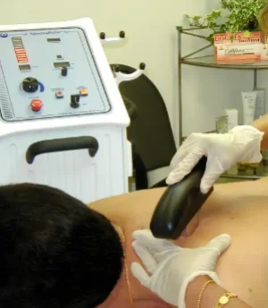 Patient for laser hair removal