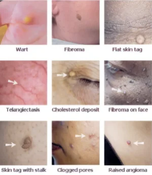 Images of skin issues